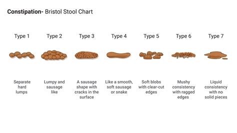 Constipation Bristol Stool Chart GI Update