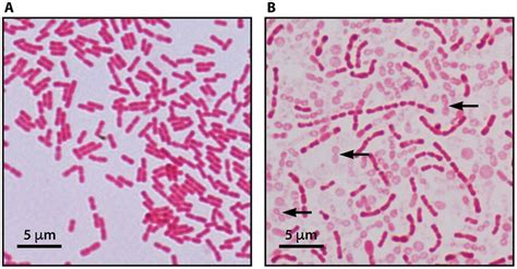 A Typical Gram Stain Of Kingella Kingae Depicting Gram Negative