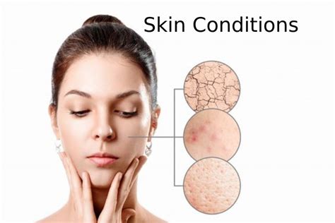 Everything You Need To Know About Common Skin Conditions