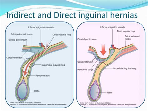 PPT The Anterolateral Abdominal Wall And Peritoneum PowerPoint