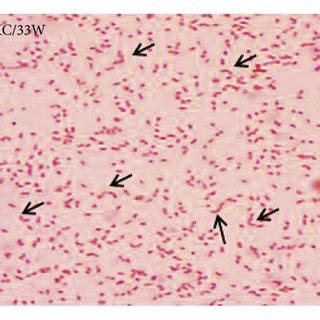 Molecular Typing Of Thermophilic Campylobacter Species Across Sample