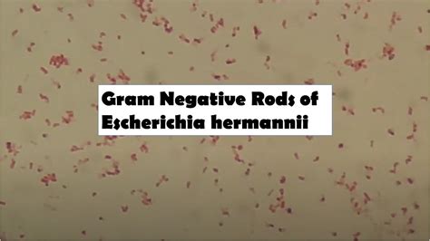 Gram Negative Rods Of Escherichia Hermannii In Gram Staining Of Culture