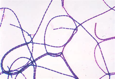 Streptococcus Bacteria Gram Stain