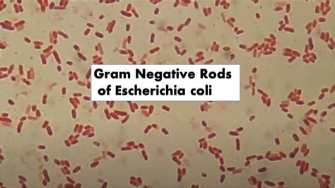 Gram Negative Rods Of Escherichia Coli Youtube