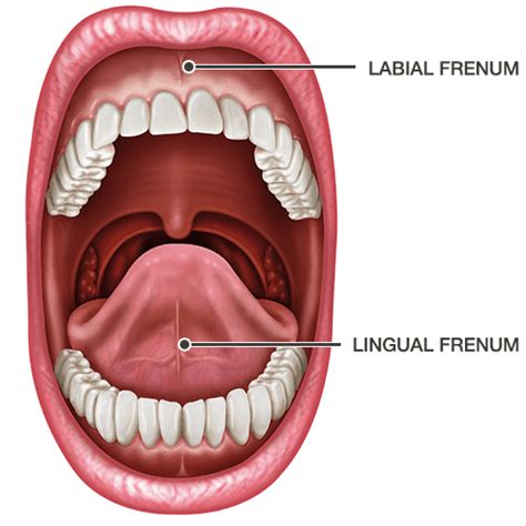 Lingual And Labial Frenectomy In Gosford Vc Dental