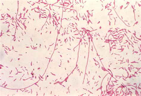 Gram Negative Rods In Chains