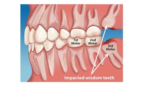 Diagram Of Teeth With Wisdom Teeth Teeth Poster