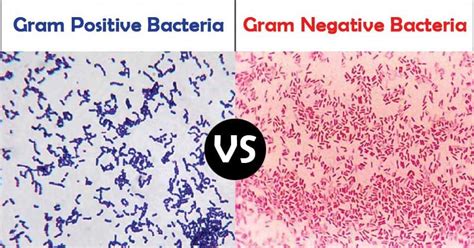 Understanding The Differences Between Gram Positive And Gram Negative