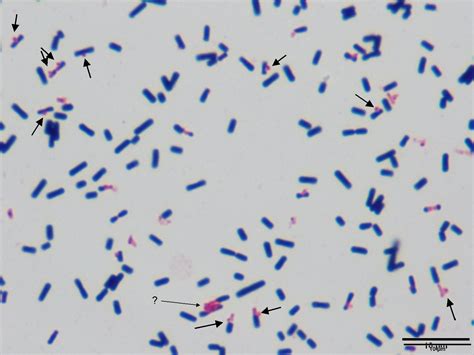 Symbionts Phase Rod Cocci Anaerobe Capsule Production Or Biofilm