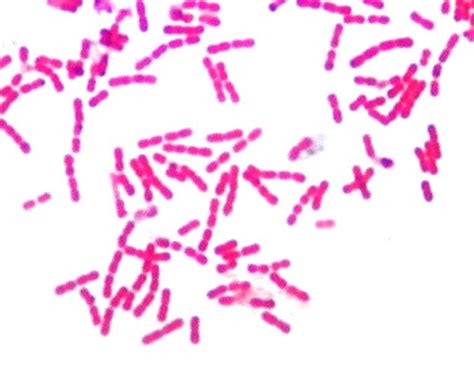 Gram Negative Rods In Chains