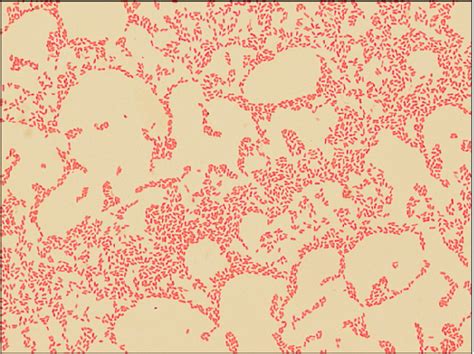 Gram Negative Bacteria Under Microscope