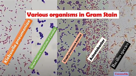 Various Bacteria Gram Stain Microscopy Gram Positive Rods Gram Negative