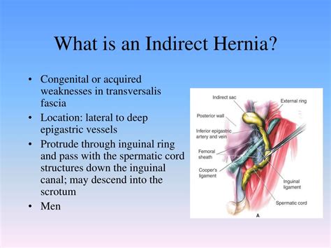 Inguinal Hernias Direct And Indirect Inguinal Hernias