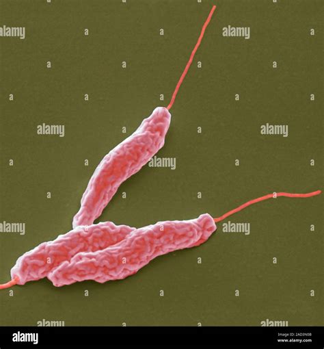 Campylobacter Jejuni Bacteria Coloured Scanning Electron Micrograph