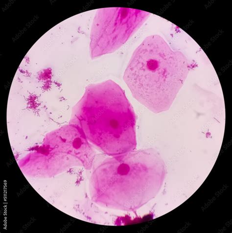 Prostatic Smear Ps Gram Stain Microscopic X Show Epithelial Cells