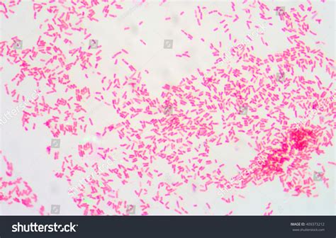 Im Genes De Gram Negative Bacilli Im Genes Fotos Y Vectores De