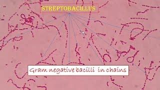 Gram Negative Rods In Chains