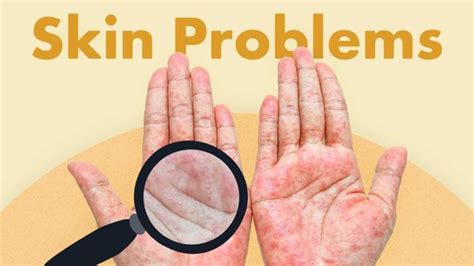 Skin Problems Ausmed Lectures