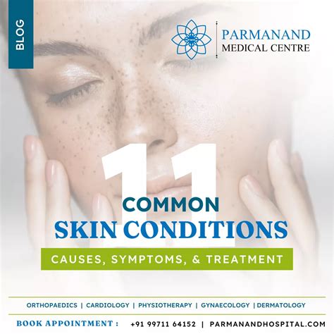 Understanding 11 Common Skin Conditions And Treatments