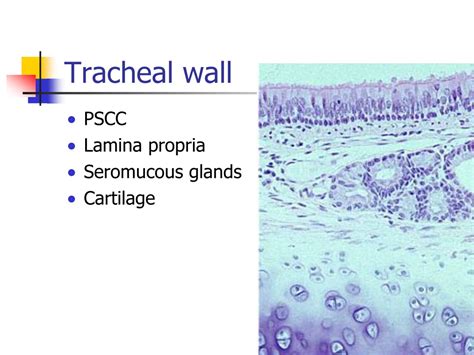 Ppt Main Structures Nose And Nasal Cavity Pharynx Larynx Trachea