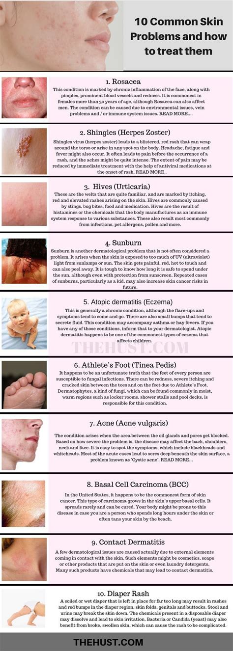 Common Skin Diseases And Conditions Explained Nbkomputer