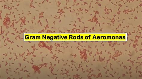 Gram Negative Rods Aeromonas Sobria Gram Staining Mag X Youtube