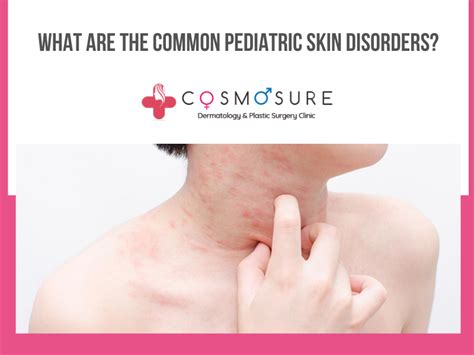 What Are The Common Pediatric Skin Disorders Cosmosure Clinic