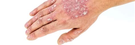 Common Skin Conditions And Treatments That Can Help Welcome To