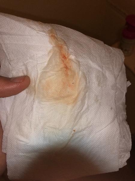 Help bleeding after positive tests :-( worried — MadeForMums Forum