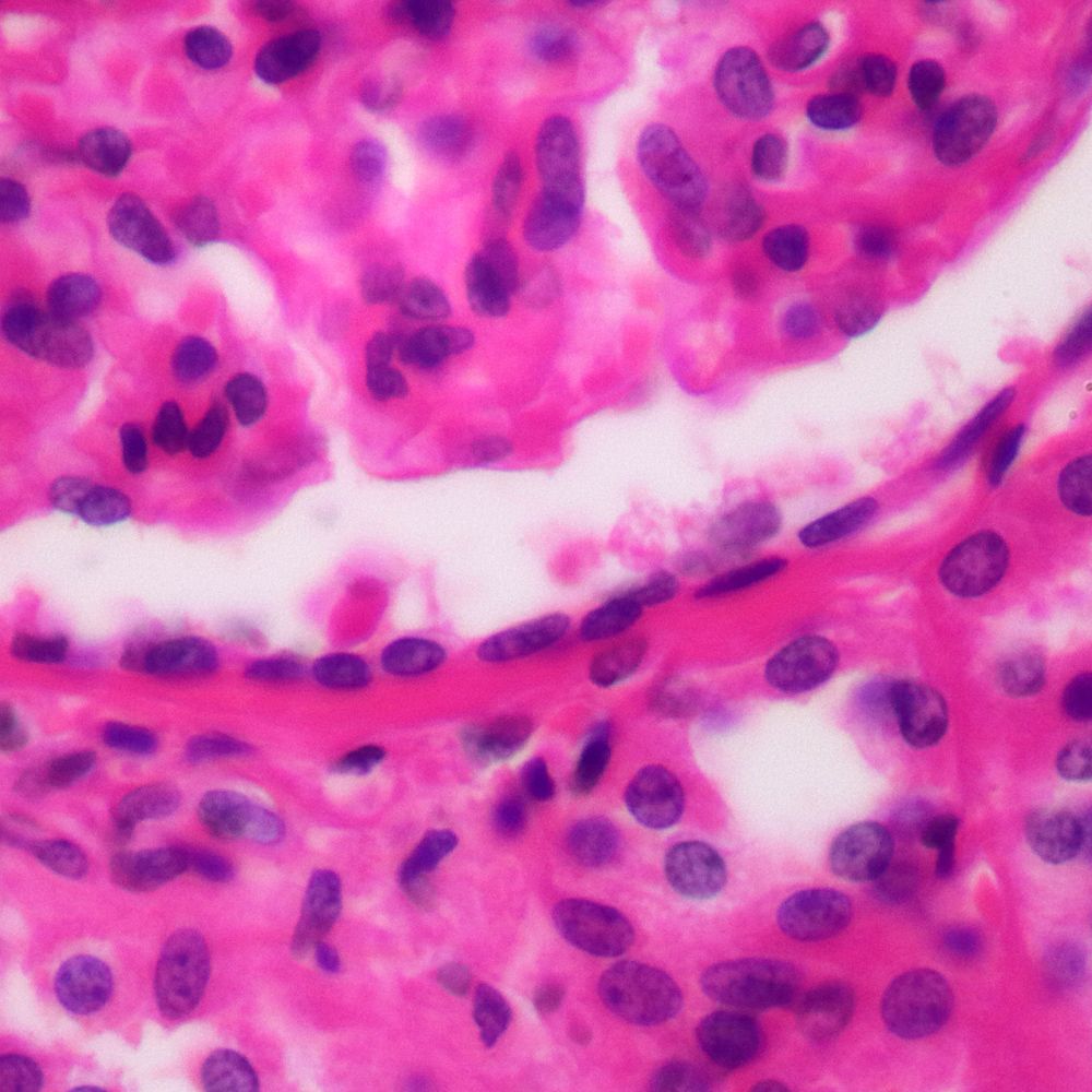 Simple Squamous Epithelial Tissue Under Microscope