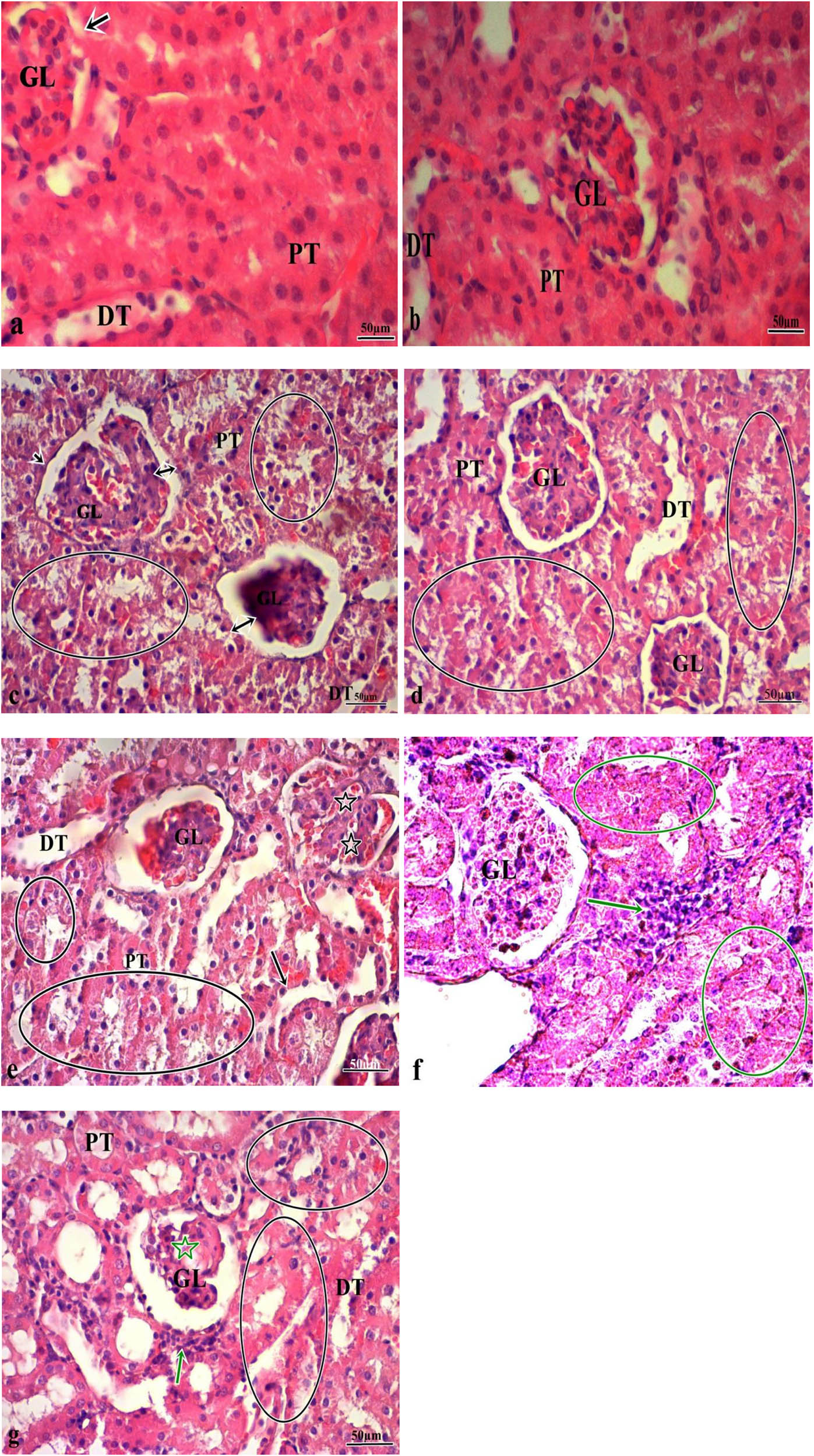 Figure 1 
                  (a and b) Kidney tissue from rats in the control and CAPE groups. Glomerular structure and tubules had a normal appearance (GL: glomeruli, PT: proximal tubule, DT: distal tubule, bowman capsule [arrowhead]). (c) Kidney tissue in 10 mg kg−1 α-CYP group (GL: glomeruli, PT: proximal tubule, DT: distal tubule, diffuse tubular degeneration [circle], enlargement in bowman capsule and glomerular atrophy [double-sided arrowhead]). (d) Kidney tissue in 10 mg kg−1 α-CYP + 10 µmol kg−1 CAPE group (GL: glomeruli, PT: proximal tubule, DT: distal tubule, diffuse tubular degeneration [circle]). (e and f) Kidney tissue in 20 mg kg−1 α-CYP group (GL: glomeruli, PT: proximal tubule, DT: distal tubule, diffuse tubular degeneration [circle], separation in the basal lamina [arrows], glomerular lobulation [asterisk], inflammatory cell infiltration [green arrow], diffuse areas of necrosis [green circle]). (g) Kidney tissue in 20 mg kg−1 α-CYP + 10 µmol kg−1 CAPE group (GL: glomeruli, PT: proximal tubule, DT: distal tubule, diffuse tubular degeneration [circle], glomerular atrophy [green star]). H&E. Bar: 50 µm.
               