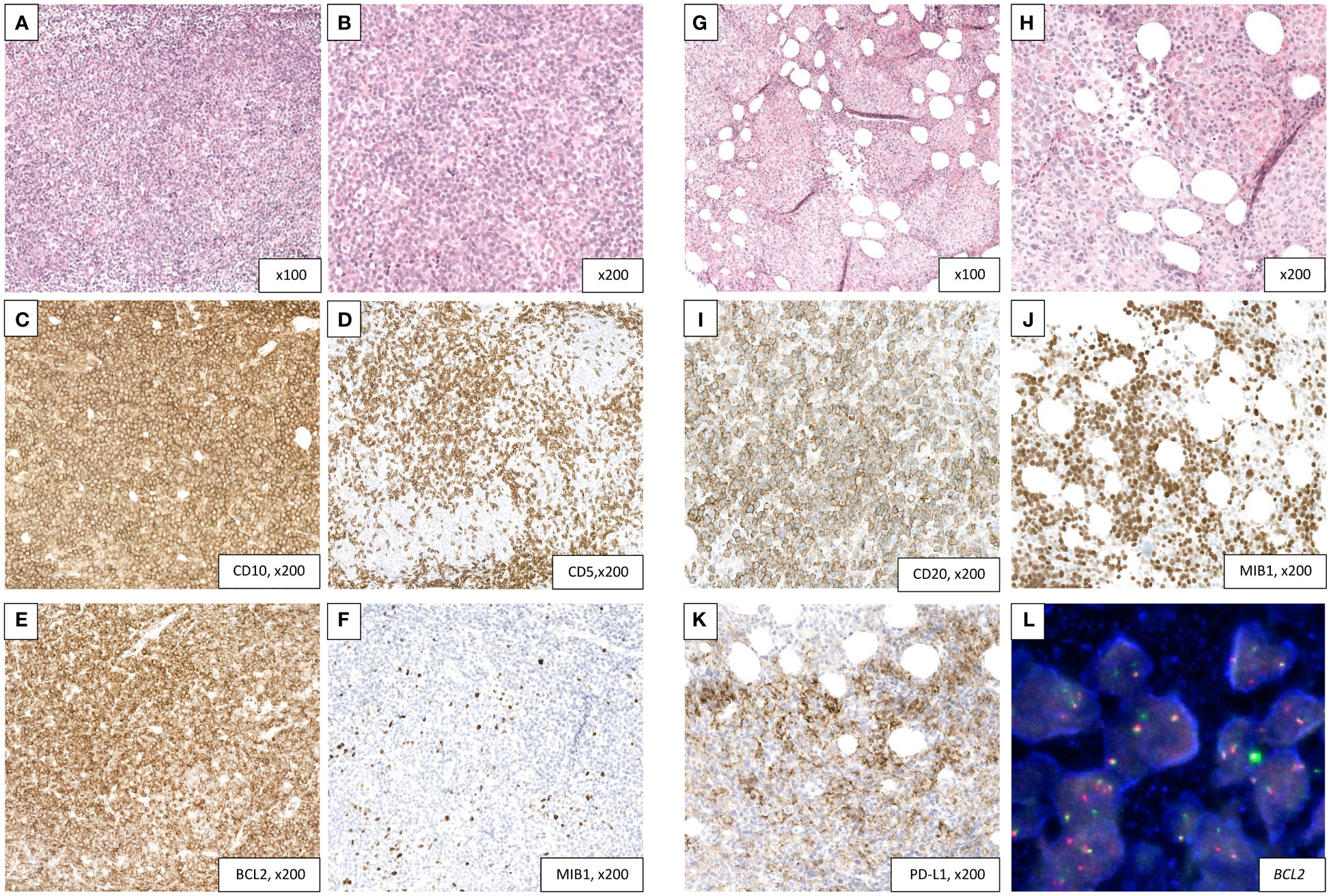 Frontiers | Case report: From sequence to solution: tailoring treatment ...