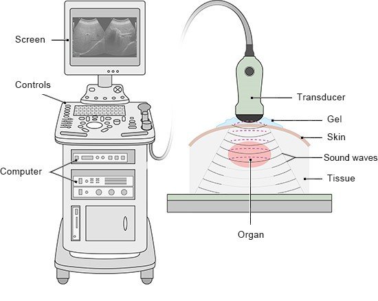 Diagram Of Ultrasound