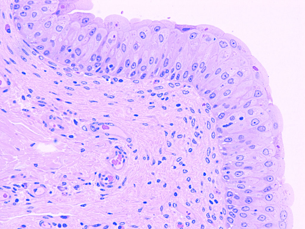 Urinary Bladder