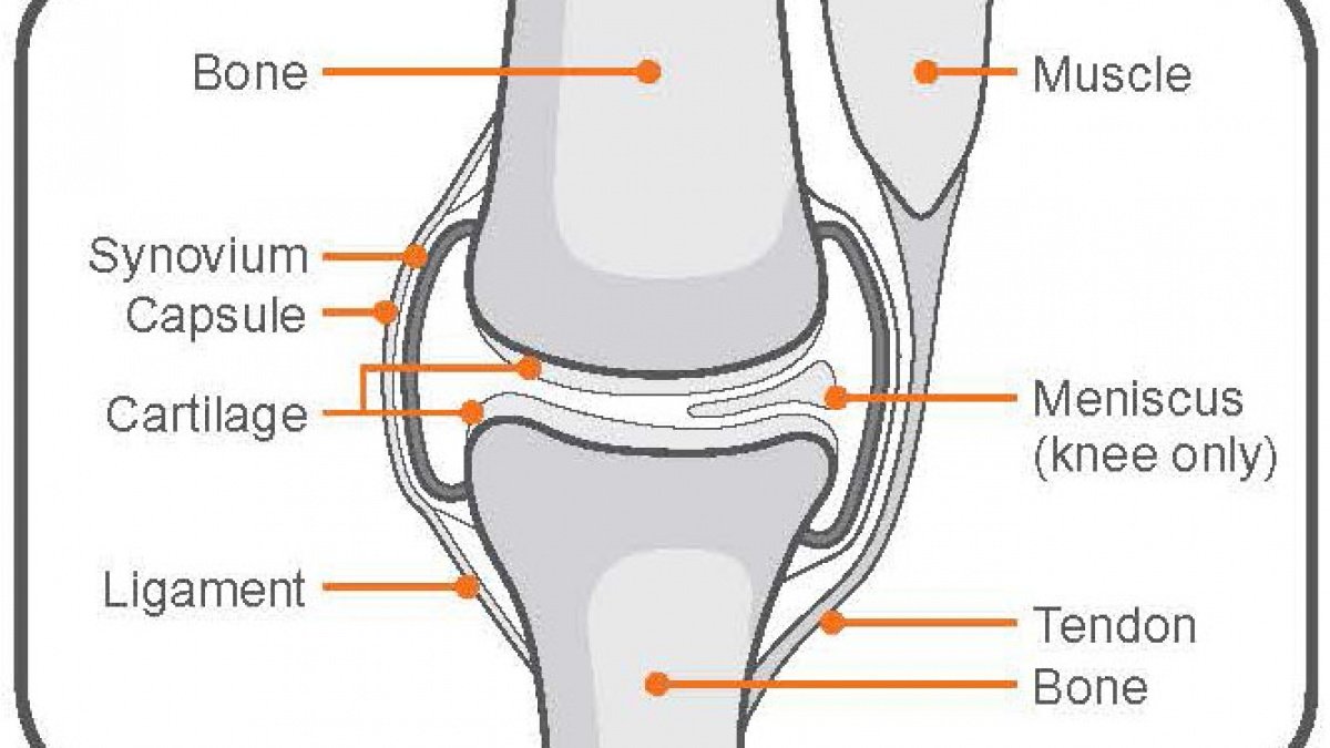 [DIAGRAM] Prosthetic Knee Diagram - MYDIAGRAM.ONLINE