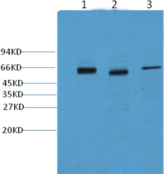 CK7 Mouse Monoclonal Antibody