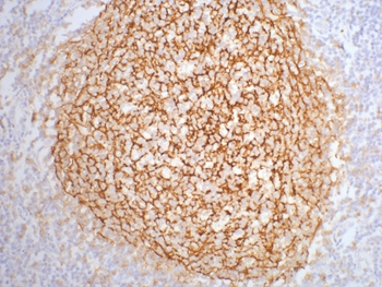 CD21 Mouse Monoclonal Antibody