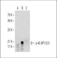 4E-BP1/2/3 (Phospho-Thr 45) Antibody