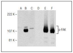 FAK (Phospho-Ser 722) Antibody