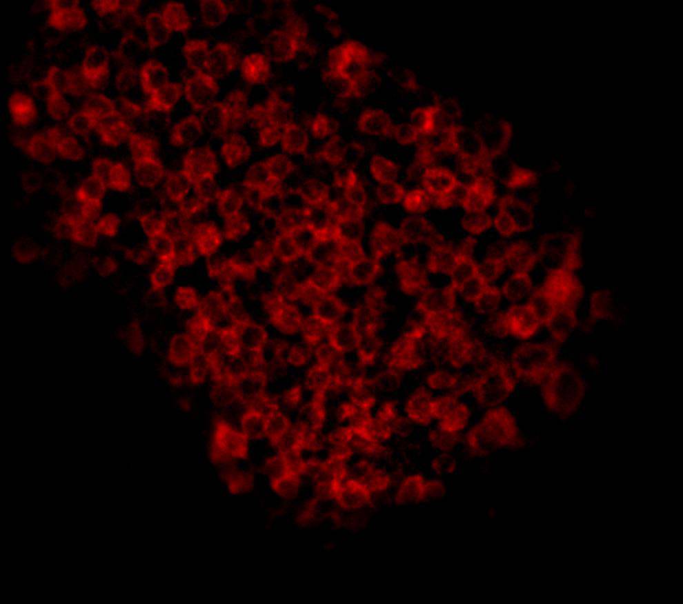 EP-CAM Antibody