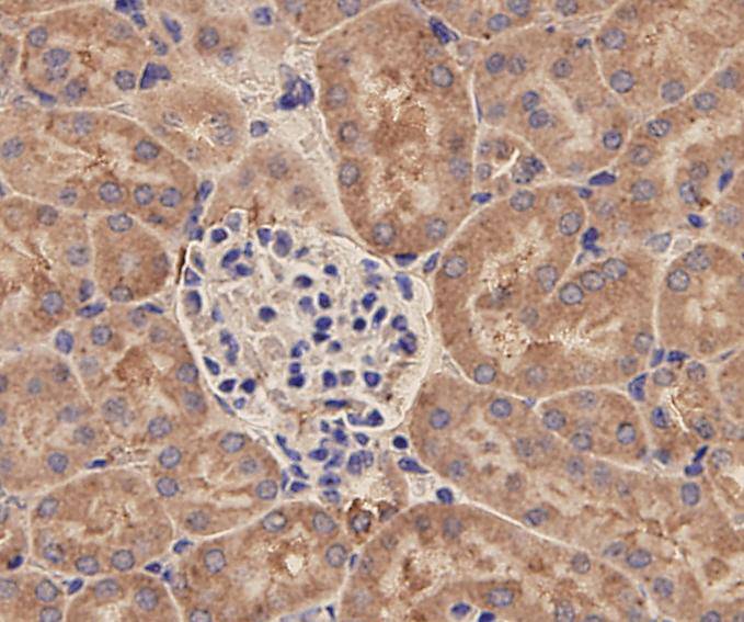 EP-CAM Antibody