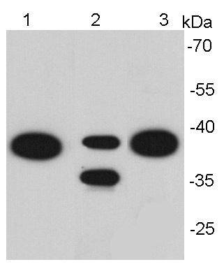 EP-CAM Antibody