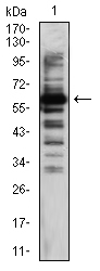 TIP60 Antibody