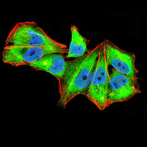 IL1RAPL1 Antibody