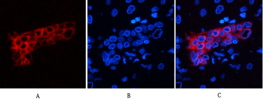 CK7 Mouse Monoclonal Antibody