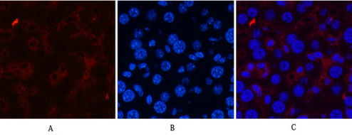 CD21 Mouse Monoclonal Antibody