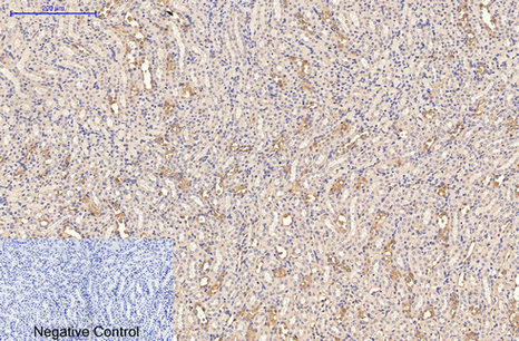 CD21 Mouse Monoclonal Antibody