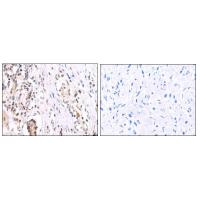 FOXP2 rabbit polyclonal antibody