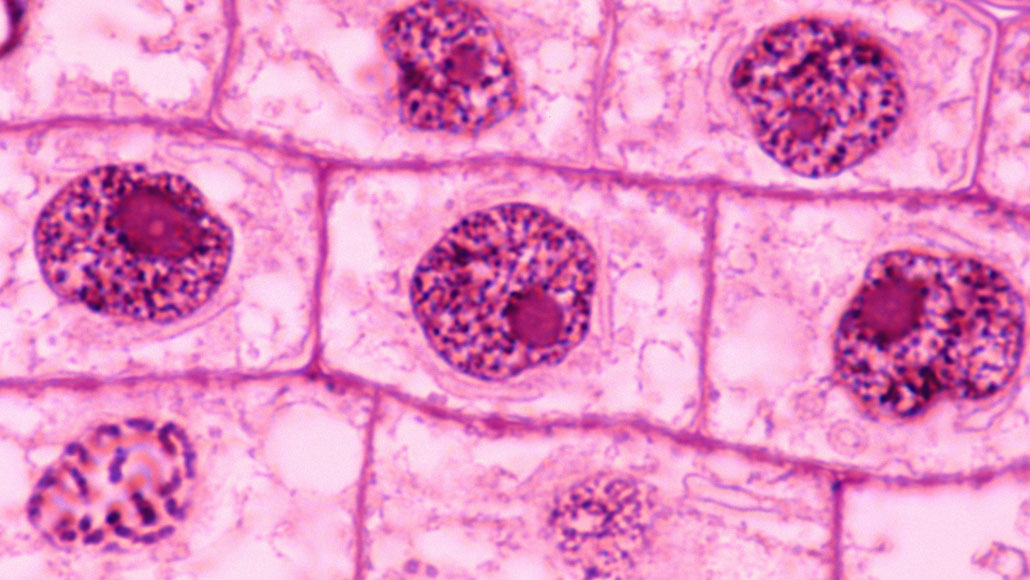 Plant Cell Nucleus Under Microscope