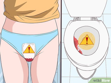 Step 4 Pay attention to a heavier menstruation.